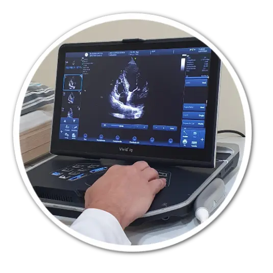 eletrocardiograma eletrocardiograma