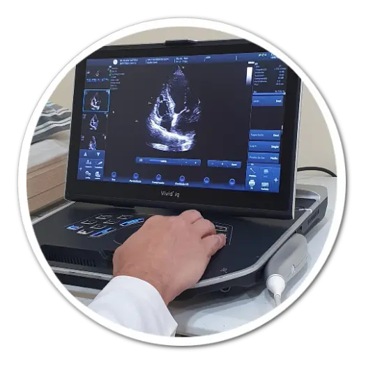eletrocardiograma