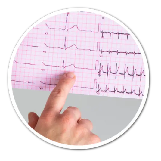 eletrocardiograma eletrocardiograma